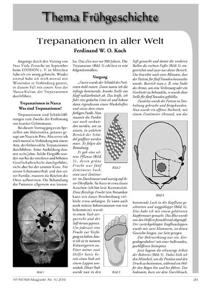 Trepanationen in aller Welt